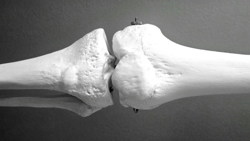kosti_osteoporoza