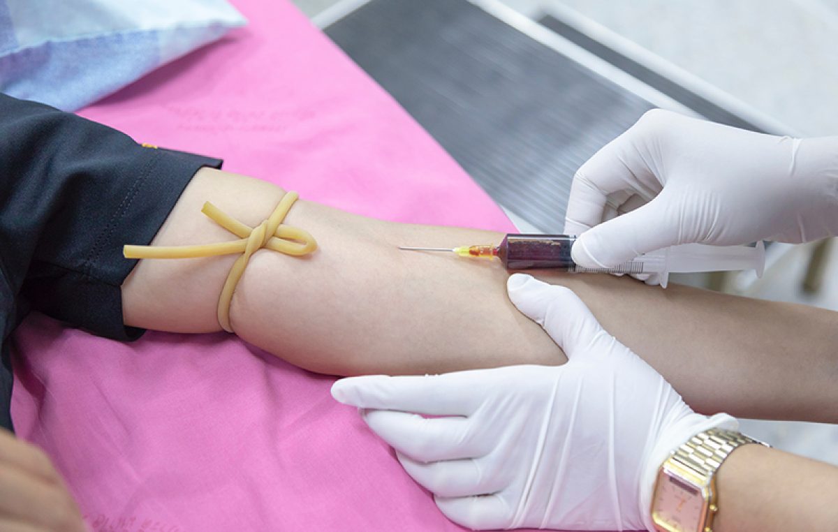 Gradsko društvo Crvenog križa Rijeka organizira akciju darivanja krvi u OŠ Srdoči