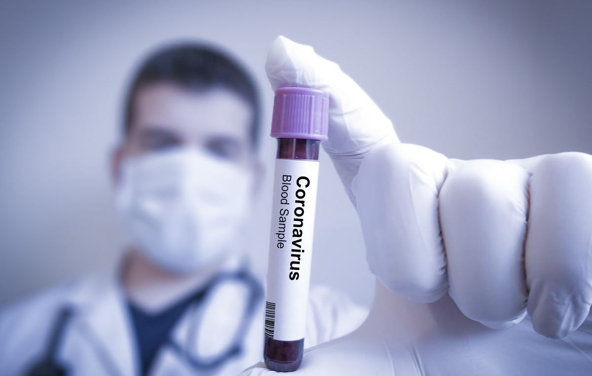 Dva nova slučaja zaraze koronavirusom u županiji, još jedan pacijent izliječen: Ukupno 50 ljudi pozitivno na COVID-19