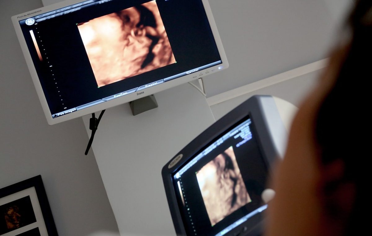 Odgođeni svi redovni, odnosno kontrolni ultrazvučni pregledi na Kliničkom zavodu za radiologiju