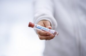 U PGŽ najviši zabilježeni broj aktivnih slučajeva tijekom 4 epidemijskog vala